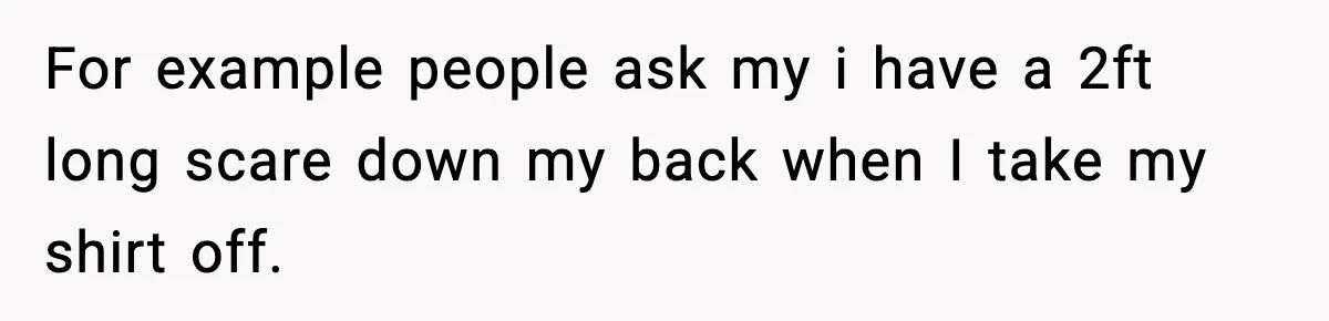 For example people ask my i have a 2ft long scare down my back when I take my shirt off.